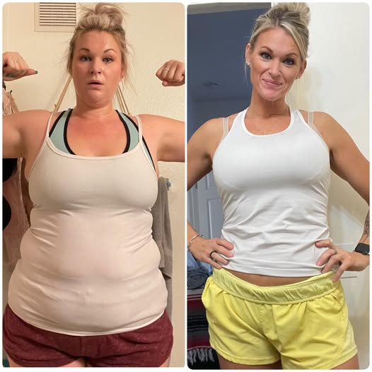 Antes e Depois